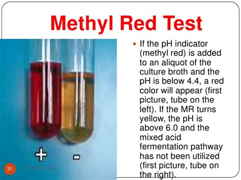 Methyl Red (MR) Test: Principle, Procedure, and Results.